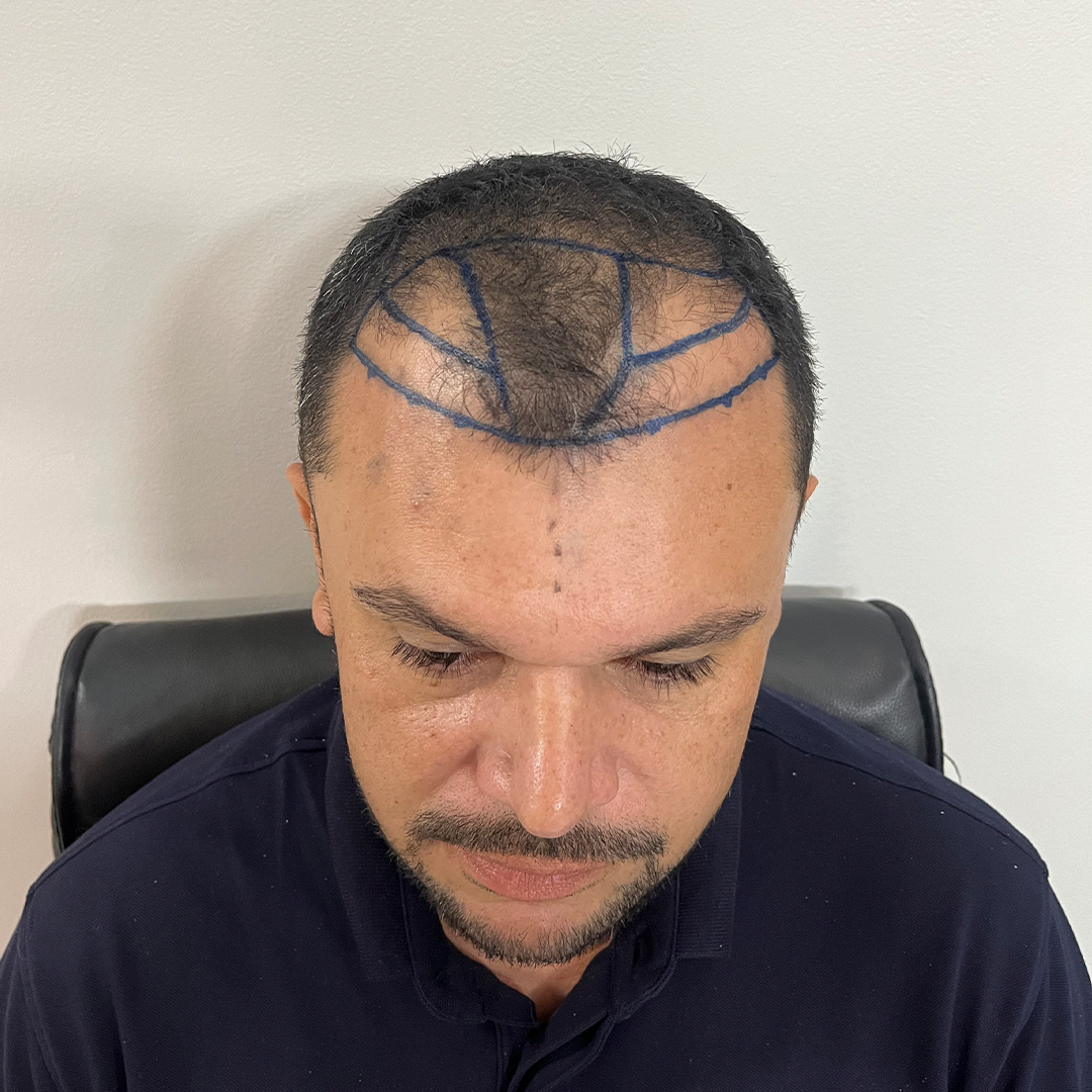 teste2